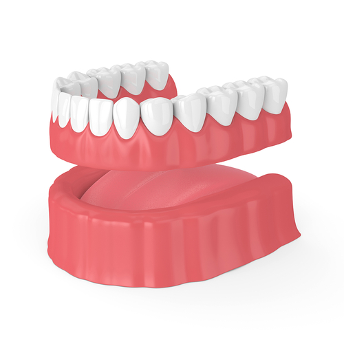implant-supported-fixed-dentures