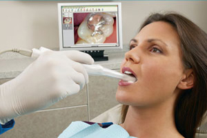 intraoral-camera